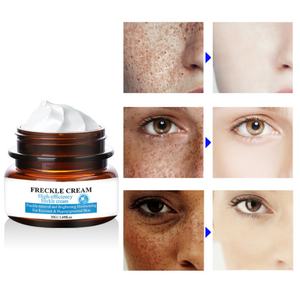 Crema y Loción Facial con Logotipo Personalizado OEM, Cuidado de la Piel con Melanina, Aclarante y Eliminador de Pecas para una Piel Más Brillante - Product Image 6