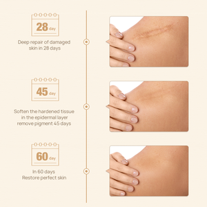 แลนเบนา ครีมลดรอยสิว รอยแผลเป็น รอยแตกลาย ซ่อมแซมผิว - Product Image 5