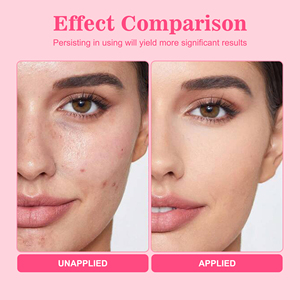 Nhãn hiệu riêng thuần chay hữu cơ cá hồi pdrn gel để bọt sữa rửa mặt với sâu lỗ chân lông làm sạch dưỡng ẩm cho da nhờn/nhạy cảm - Product Image 5