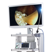 Système d'endoscopie vidéo de définition de bon prix avec la meilleure qualité Endoscope SonoScape UHD