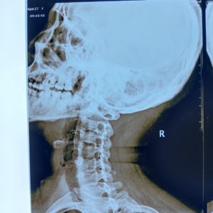 Film radiographique médical à jet d'encre bleu compatible avec les imprimantes ; compatible avec les imprimantes à jet d'encre de bureau et grand <span class=keywords><strong>format</strong></span> - Product Image 2