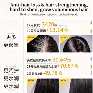 <span class=keywords><strong>Shampoo</strong></span> Anticaduta allo Zenzero e Foglie di Biota, Rinfrescante, Controllo dell'Oleosità, Volumizzante, <span class=keywords><strong>Shampoo</strong></span> per <span class=keywords><strong>la</strong></span> Cura <span class=keywords><strong>dei</strong></span> <span class=keywords><strong>Capelli</strong></span> Lisci - Product Image 3