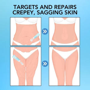 2024 Venta caliente nd reafirmante crema de mantequilla juvenil Etiqueta Privada orgánica cuerpo celulitis Crema para estrías - Product Image 4