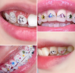 12 grilles ongles <span class=keywords><strong>strass</strong></span> 2MM 3MM 4MM bricolage <span class=keywords><strong>dent</strong></span> gemme Kit pas de colle fleur <span class=keywords><strong>papillon</strong></span> or <span class=keywords><strong>dent</strong></span> gemme pour la décoration des dents - Product Image 3