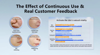 Aqua Hydra Machine Facial-Desktop Hydro Dermabrasion Eau Oxygène Jet Peel Aqua Peeling Solution Hydra Machine Facial