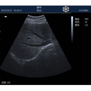 Machine à ultrasons vétérinaire portable, scanner pour vétérinaire <span class=keywords><strong>bovin</strong></span> équin, machine à ultrasons vétérinaire - Product Image 6