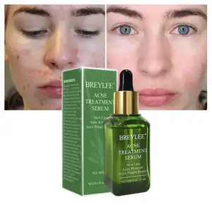 BREYLEE tea tree acne herbal treatment acne pimple remover serum anti acne