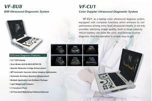 Ecógrafo Doppler Portátil Blanco y Negro para Laptop, Dispositivo Médico de Metal, <span class=keywords><strong>Fisioterapia</strong></span>, Ultrasonido Veterinario - Product Image 6