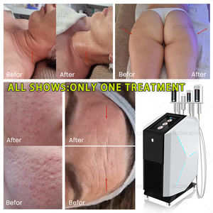 フェイシャルマッサージ減量ローラー痩身美容真空機脂肪除去美容センターボディ痩身と肌の引き締め - Product Image 4