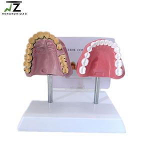 Modelo Anatómico Educativo Médico para Comparación de Dientes Humanos Saludables y con Efectos del Tabaco - Product Image 2