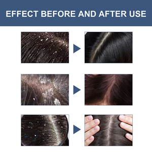 Stiker kustom minyak biji labu organik Biotin krim Scrub kulit kepala 2-in-1 Perawatan Rambut mengurangi ketombe pelembap - Product Image 6