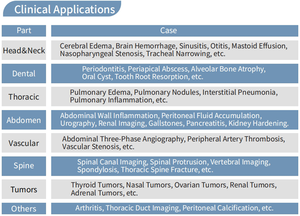 DERRY pemindai CT dokter hewan, peralatan pemindai CBCT tomografi terkomputerisasi sinar kerucut - Product Image 4