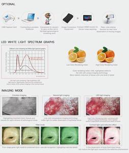 कर्नेल KN-2200 डिजिटल वीडियो कोलोपोस्कोप पोर्टेबल योनि कोपोस्कोप के लिए सस्ती कीमत - Product Image 4