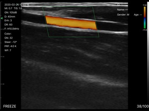 Sonda inalámbrica Doppler a color 3 en 1 DMU40 de alta calidad y gran éxito de ventas con alta calidad y resolución de imagen para animales - Product Image 5