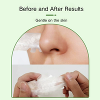 Hydrocolloïde de haute qualité pour le nez, nouvelle arrivée, hypoallergénique, grand patch invisible pour les boutons, soin du nez