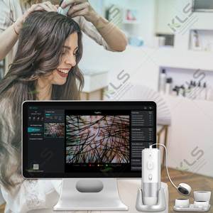 Máy quét da đầu, phân tích tóc cầm tay chất lượng cao HD / Máy phân tích tóc và da đầu - Product Image 1