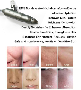Appareil professionnel d'infusion d'essence sans aiguille, mode de pulvérisation continu et intermittent, soin du cuir chevelu et des peaux sensibles - Product Image 2