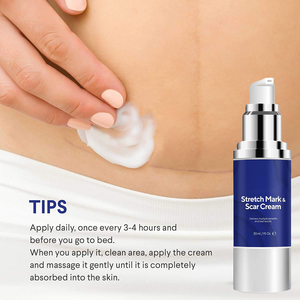 Xoài mẹ tốt nhất thai sản vết rạn da Kem điều trị loại bỏ sửa chữa Kem cơ thể - Product Image 6