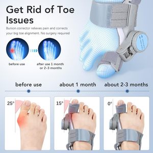 <span class=keywords><strong>Corrector</strong></span> de Juanetes para Mujeres <span class=keywords><strong>y</strong></span> Hombres, Enderezador de Dedo Gordo del Pie, Perilla Ajustable, Ortesis de Nailon para Juanetes, Soporte Antideslizante para Alivio del Dolor - Product Image 2