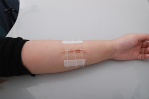 Dispositif de fermeture cutanée jetable pour la réparation des sutures à fermeture rapide - Product Image 5