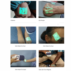 Balayage des vaisseaux sanguins Équipement médical Affichage visuel Corps Détecteur de veine faciale Scanner de veine infrarouge Balayage des vaisseaux sanguins - Product Image 5