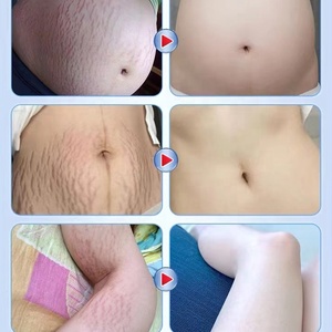妊娠線除去オイルトリートメント マタニティケア アンチエイジング しわ対策 ハリのある肌へ ストレッチマークボディオイル - Product Image 2