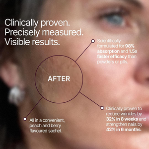 คอลลาเจนเหลวสำหรับผู้หญิง ไบโอติน โคคิวเท็น วิตามินซี 2500 มก. คอลลาเจนเปปไทด์ บำรุงผม ผิว เล็บ 30 ซอง อา<span class=keywords><strong>หา</strong></span>รเสริมแบบดื่ม - Product Image 4