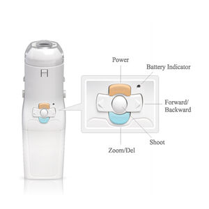 Colposcopio Portátil Mini, Equipo Médico Eléctrico de Diagnóstico Cervical con Video para Ginecología, Herramienta de Examen Femenino - Product Image 6