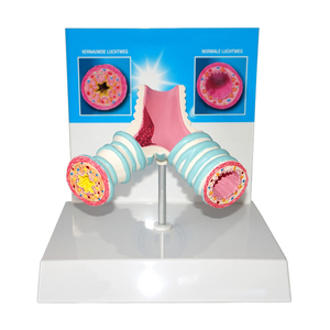 Modello di Trachea, bronco e cavità segmentale per l'educazione del paziente - Product Image 1