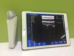 Mesin medis USG Linear Genggam kualitas tinggi, pemindai <span class=keywords><strong>Ultrasound</strong></span> portabel nirkabel IOS Android <span class=keywords><strong>Ultrasound</strong></span> Linear - Product Image 6