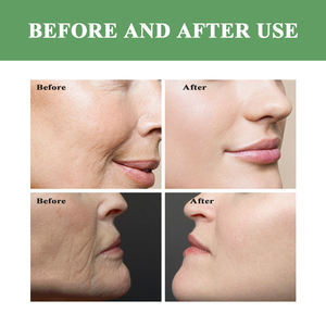 Tonique anti-<span class=keywords><strong>rides</strong></span> QBEKA pour une peau jeune, réduit les ridules et les <span class=keywords><strong>rides</strong></span>, éclaircit et hydrate le visage pour une peau éclatante - Product Image 5