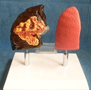 Modelo de patología pulmonar humana para ciencias médicas: modelo de enfermedad pulmonar, modelo de enfermedad orgánica, modelo antidrogas - Product Image 4