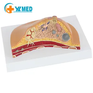 Medical science Female breast cancer pathological cross-section anatomical model Breast medicine model