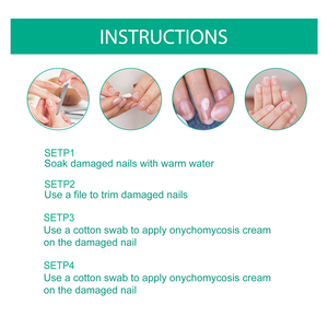 Мазь от грибка ногтей South Moon 20г, крем для питания и восстановления ногтей, снимающий бактериальные и грибковые инфекции - Product Image 3