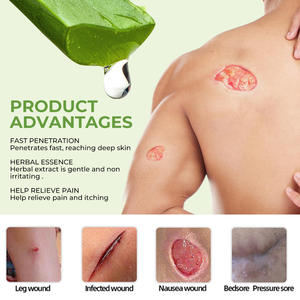 Crème anti-escarres 20g pour les soins des pieds et du corps, sans produits chimiques agressifs, contient de l'aloe vera - Product Image 6