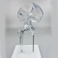 Modèle transparent d'implant de joint de hanche, modèle de remplacement, taille mini, modèle de présentation générique transparent