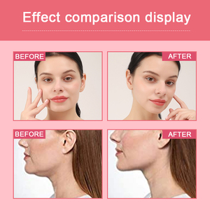 Masker Lembar Pengencang Wajah Bentuk V untuk Leher dan Dagu, Masker Pengangkat Wajah Hidrogel Kolagen & Vitamin C untuk Semua Jenis Kulit - Product Image 2