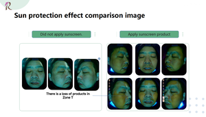 Geely cat <span class=keywords><strong>Sunwin</strong></span> Ai Phone Camera Capteur d'humidité Muti-Language SPA Beauty Machine Skin Analyzer - Product Image 4