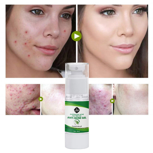 Oem/ODM nhãn hiệu riêng cây trà nổi mụn đốm đen Remover vết sẹo làm sạch sâu mặt chăm sóc da sửa chữa mụn Gel Kem - Product Image 6