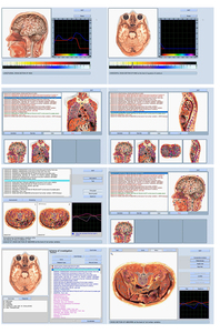 Appareil de diagnostic quantique avancé pour l'évaluation du métabolisme des nutriments et le dépistage des dysfonctions organiques pré-pathologiques - Product Image 5