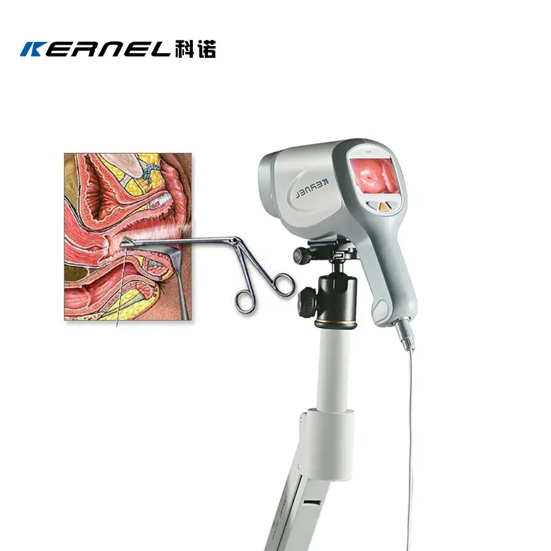 Медицинский цифровой гинекологический кольпоскоп HD видео вагинальная камера для гинекологии влагалища эндоскоп