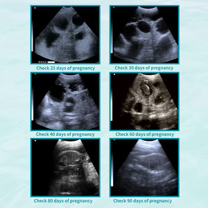 Mesin Peralatan USG Hewan Portabel 5,7 Inci dengan Probe Mekanis untuk Kehamilan Hewan - Product Image 6