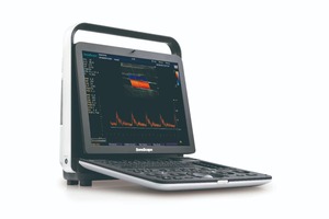 Échographe Doppler Couleur Portable SonoScape S9 Pro avec Batterie Intégrée pour Hôpital - Product Image 3