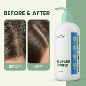 <span class=keywords><strong>Shampoo</strong></span> <span class=keywords><strong>per</strong></span> la Cura del <span class=keywords><strong>Cuoio</strong></span> <span class=keywords><strong>Capelluto</strong></span> con AHA, Esfoliante e Purificante, <span class=keywords><strong>per</strong></span> <span class=keywords><strong>Cuoio</strong></span> <span class=keywords><strong>Capelluto</strong></span> Grasso e con Forfora - Product Image 1