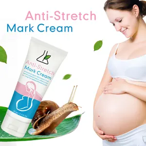 Custom Natural Herbal Stretch Marks Cream Remove Stretch Marks Fade Scars Moisturizing Whitening Stretch Marks Removal Cream