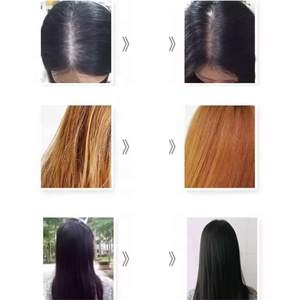 Shampoo apaisant pour cuir chevelu Nizo OEM 24 heures, très vendu au Royaume-Uni, pour cheveux bouclés secs et sujetts à l'eczéma, offre un soulagement durable, doux et soyeux - Product Image 4