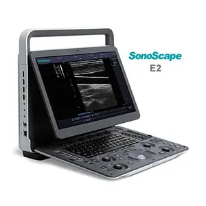 Medische Echografie Instrument Msk Ob/Gyn Draagbare Sonoscape E2 Echografie Machine Prijs Te Koop