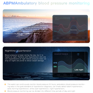 La ricarica magnetica Rlojes Smartwatch 510Mah 4G Android 2024 nuova tecnologia supporta il monitoraggio dinamico della frequenza cardiaca Smartwatch - Product Image 6