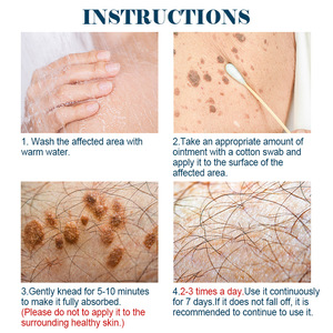 <span class=keywords><strong>Crema</strong></span> de Tratamiento <span class=keywords><strong>para</strong></span> <span class=keywords><strong>Verrugas</strong></span> <span class=keywords><strong>Genitales</strong></span> 100% Natural a Base de Hierbas, <span class=keywords><strong>Crema</strong></span> <span class=keywords><strong>para</strong></span> Eliminar <span class=keywords><strong>Verrugas</strong></span> <span class=keywords><strong>Genitales</strong></span> - Product Image 4