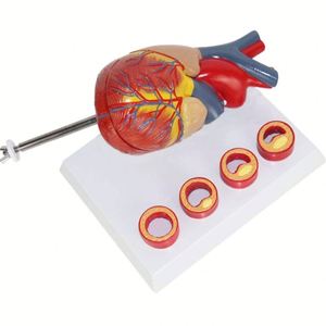 Modelo de corazón KyrenMed corazón con modelo de trombo - Product Image 2